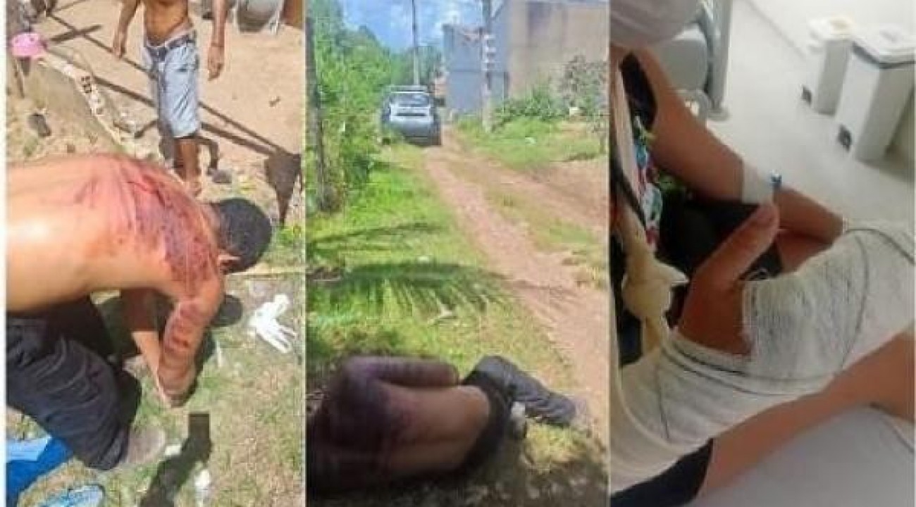 Homem é preso após cortar dedos de ex-namorada em frente aos filhos